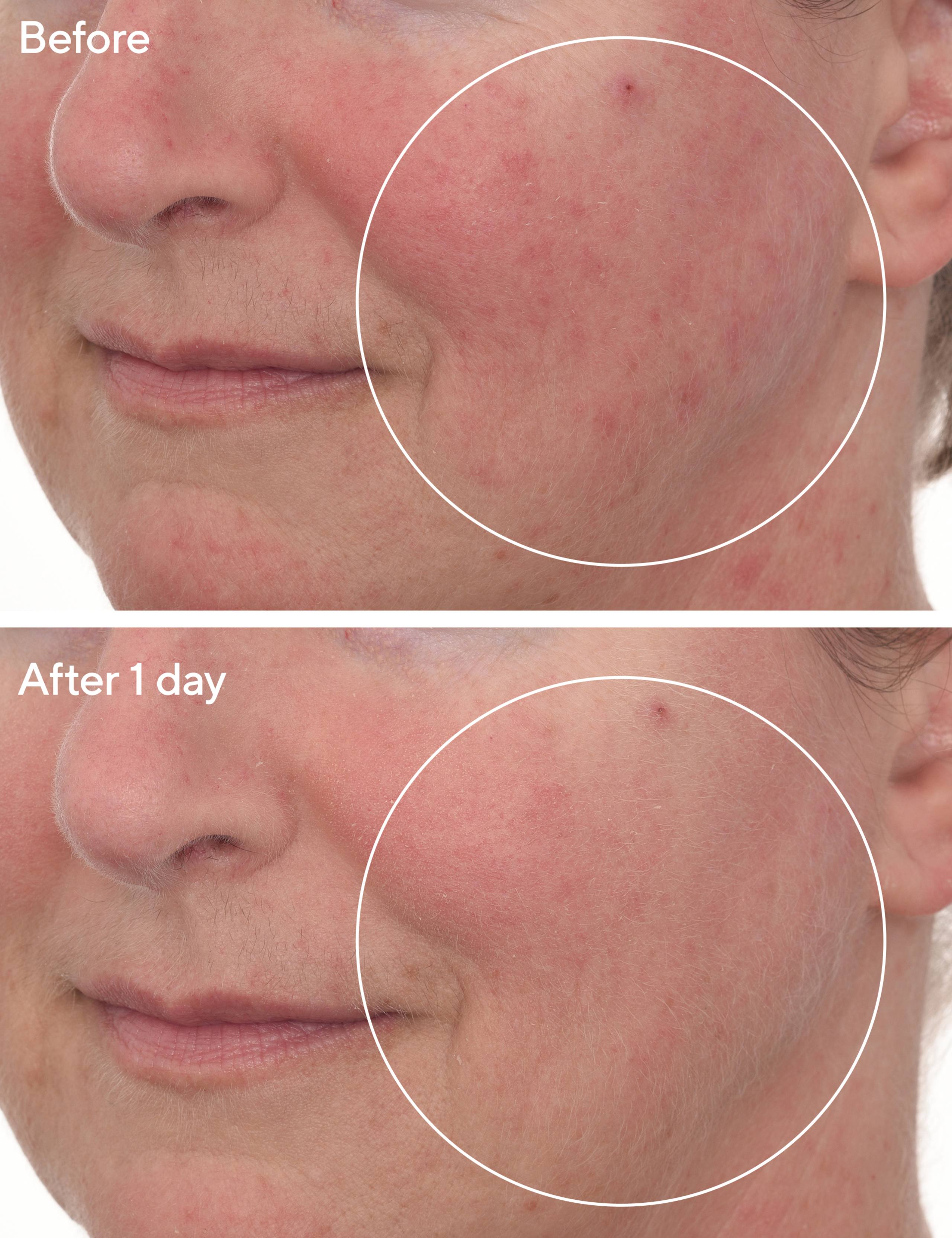 Cellular Hydration Barrier Repair Mask 80ml 3 of 5