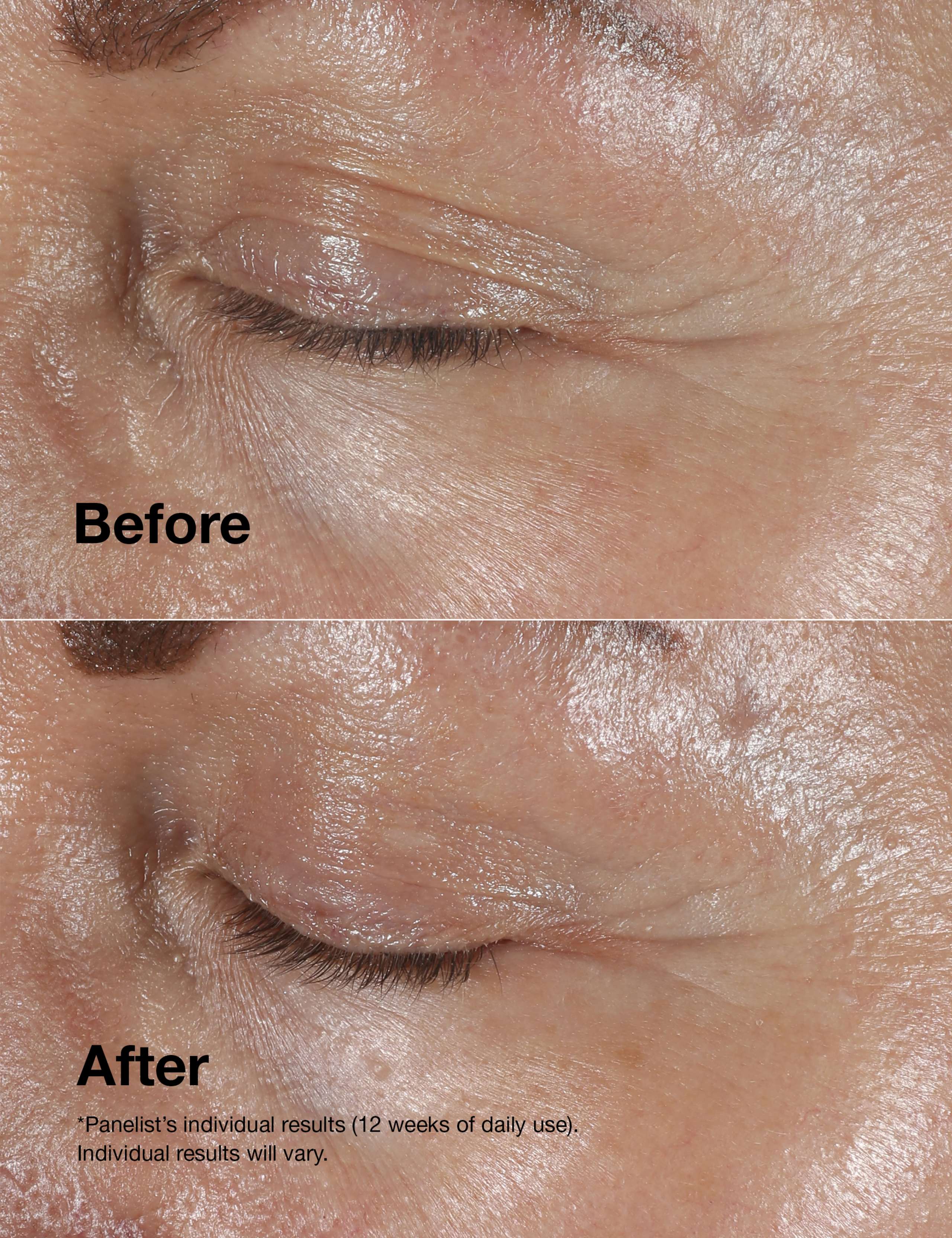 Smart Clinical Repair™ Wrinkle Correcting Eye Cream 15ml 3 of 7