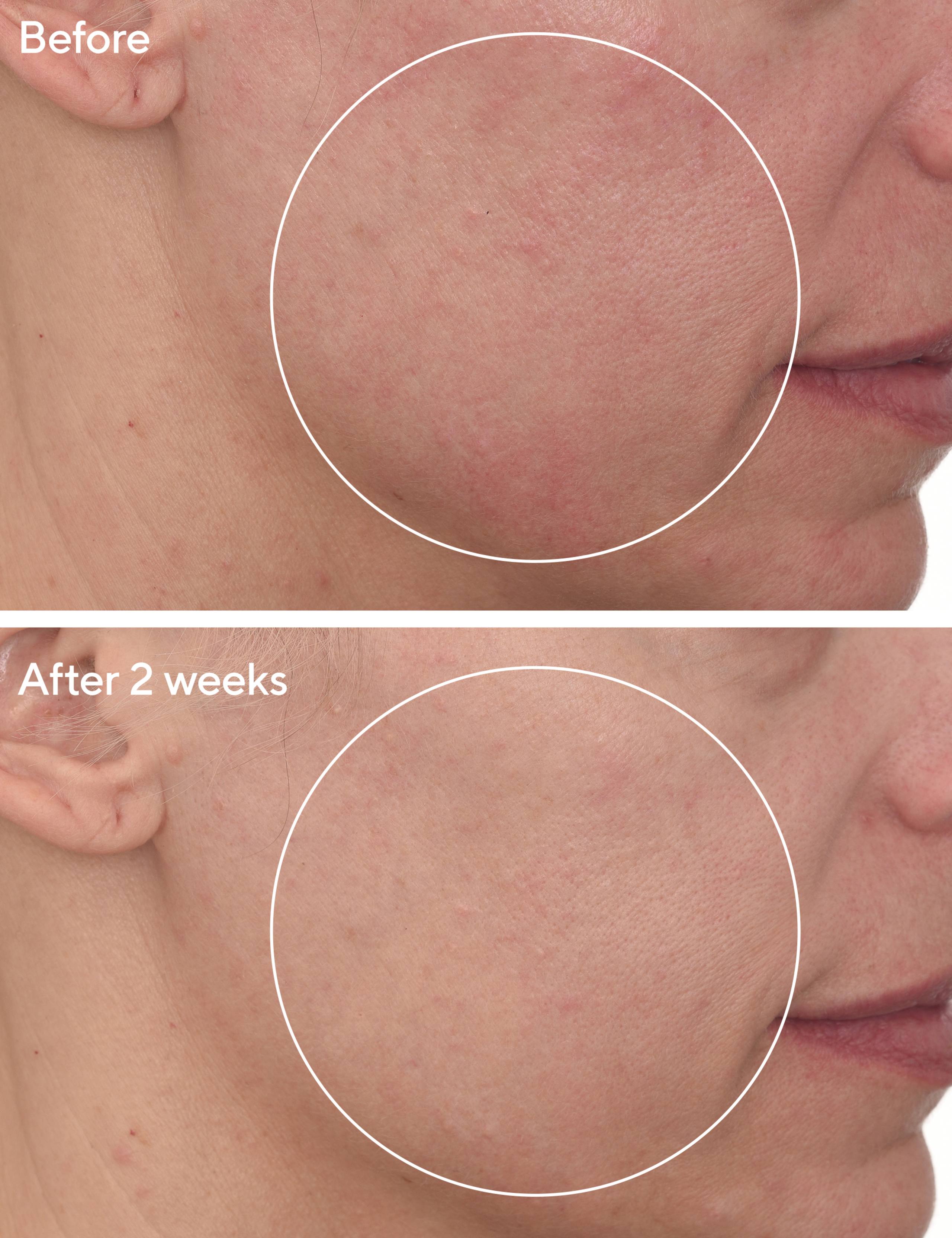 Cellular Hydration Barrier Repair Cream 50ml 3 of 5