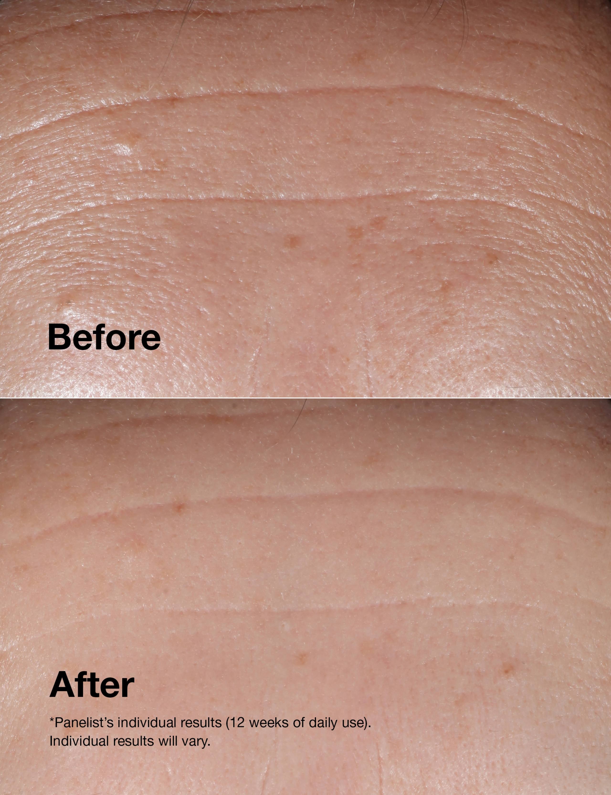 Smart Clinical Repair™ Wrinkle Correcting Serum 50ml 3 of 7