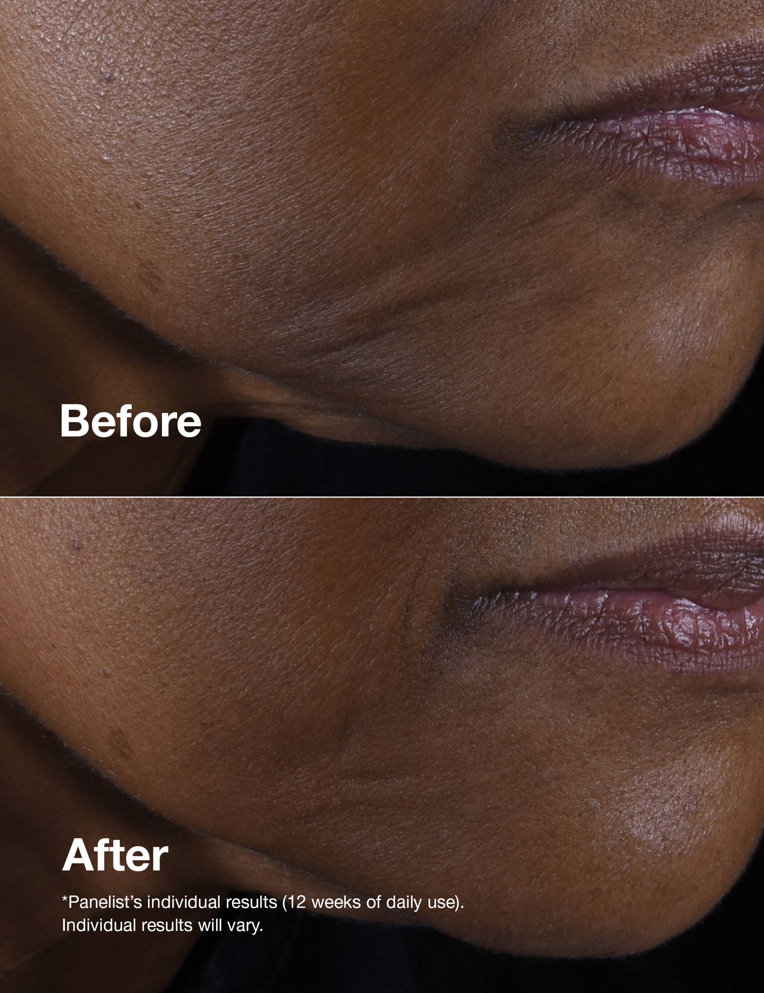 Smart Clinical Repair™ Lifting Face + Neck Cream 50ml 3 of 9