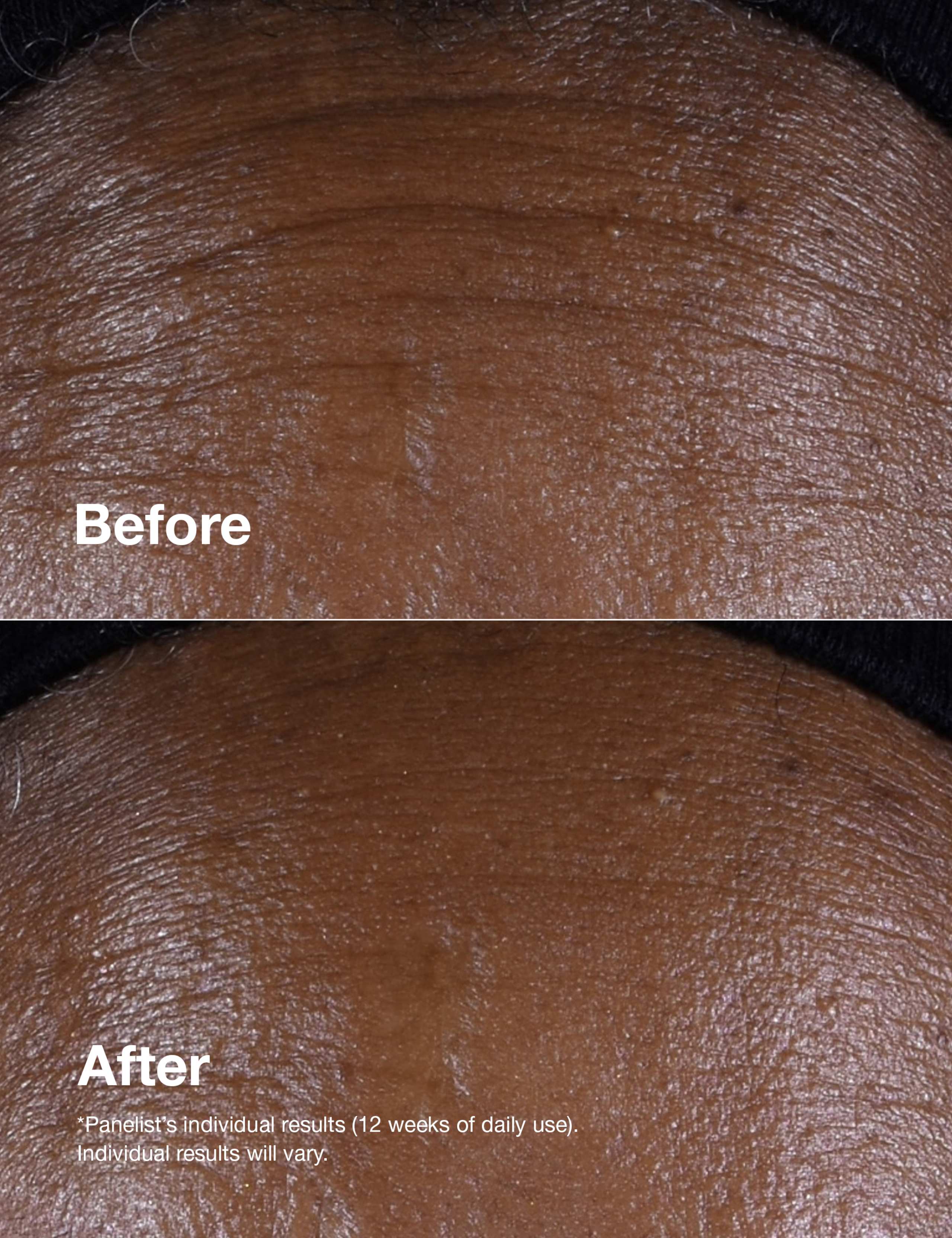 Smart Clinical Repair™ Lifting Face + Neck Cream 50ml 8 of 9