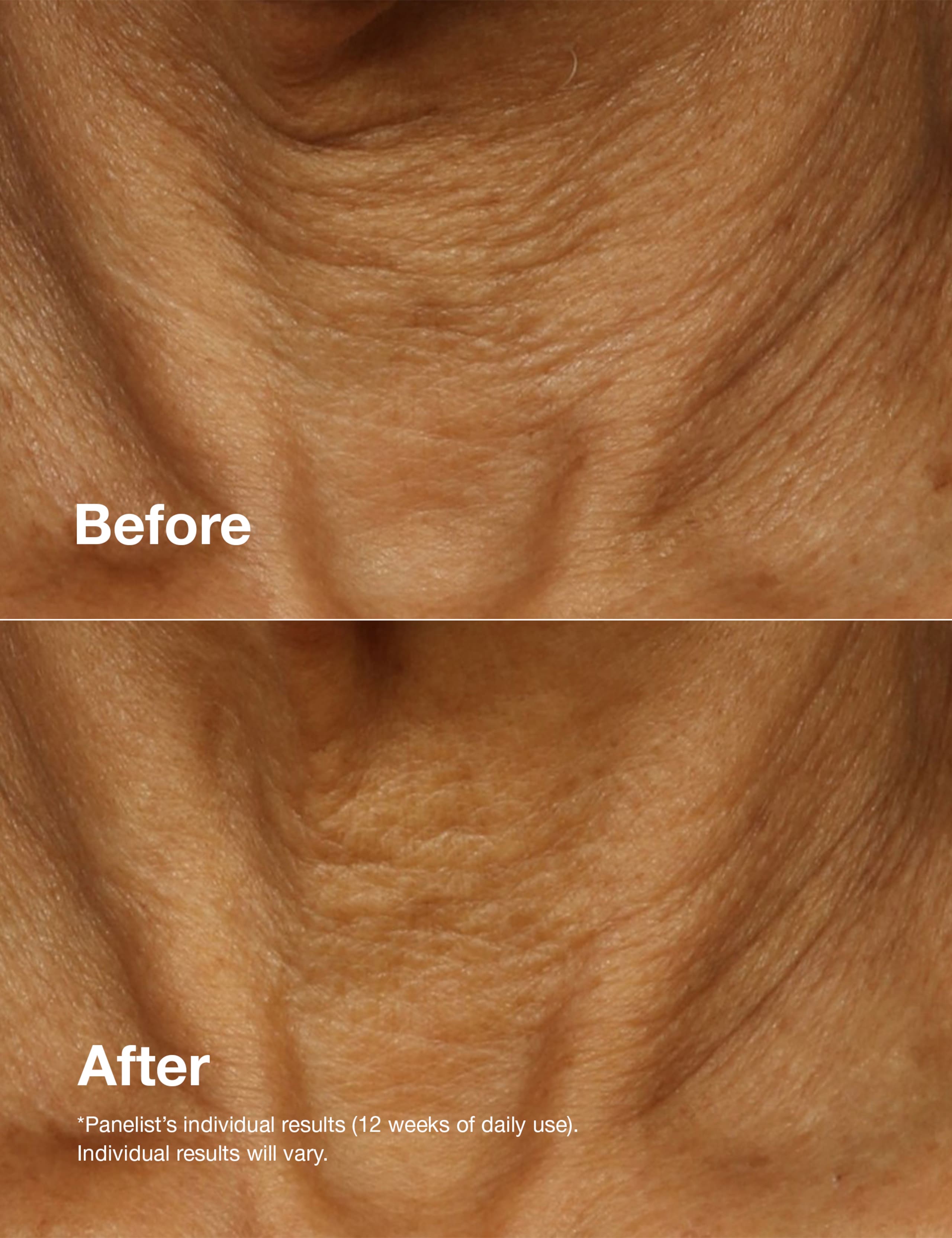 Smart Clinical Repair™ Lifting Face + Neck Cream 50ml 9 of 9