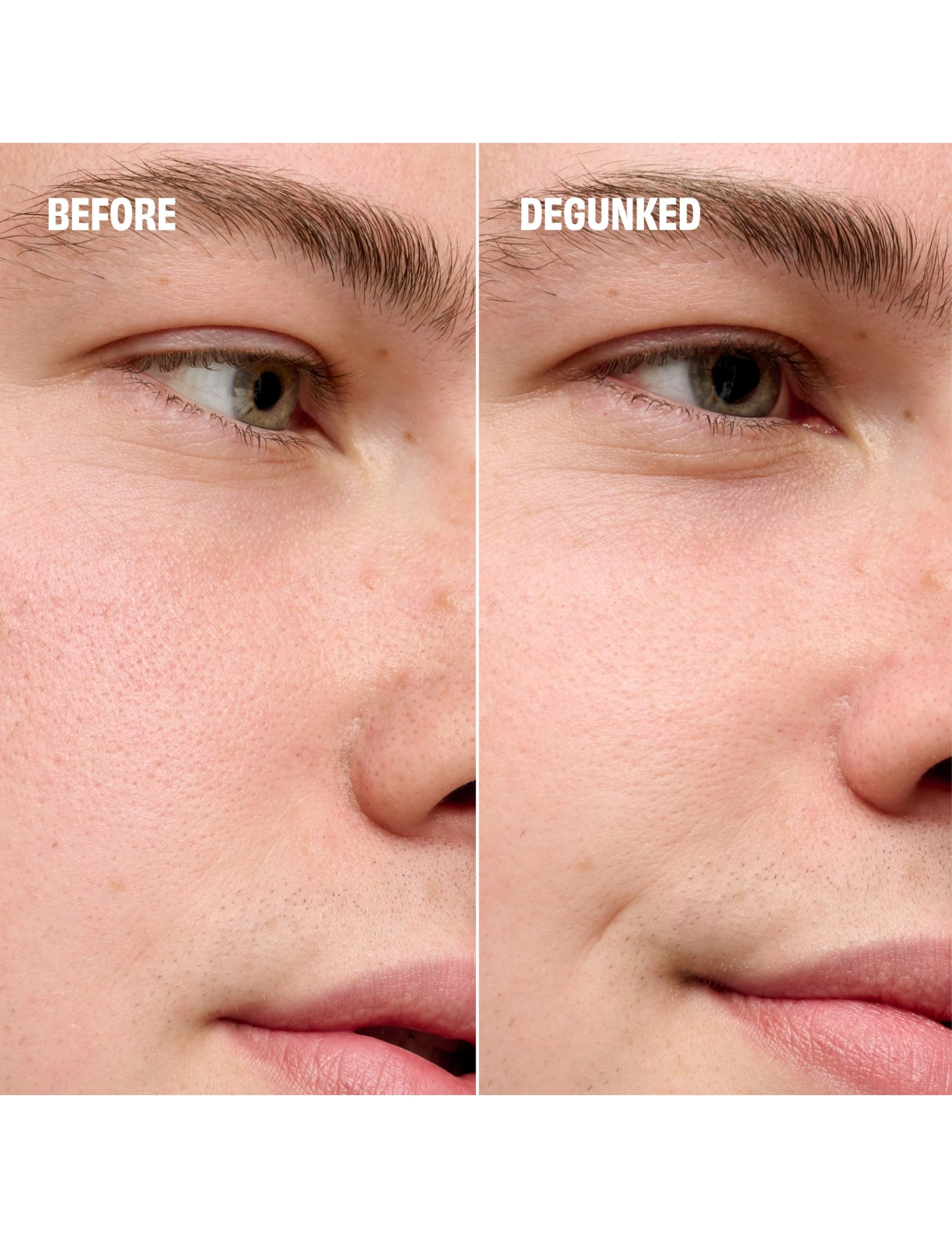 The Porefessional Degunker Pore Cleansing System 4 of 7