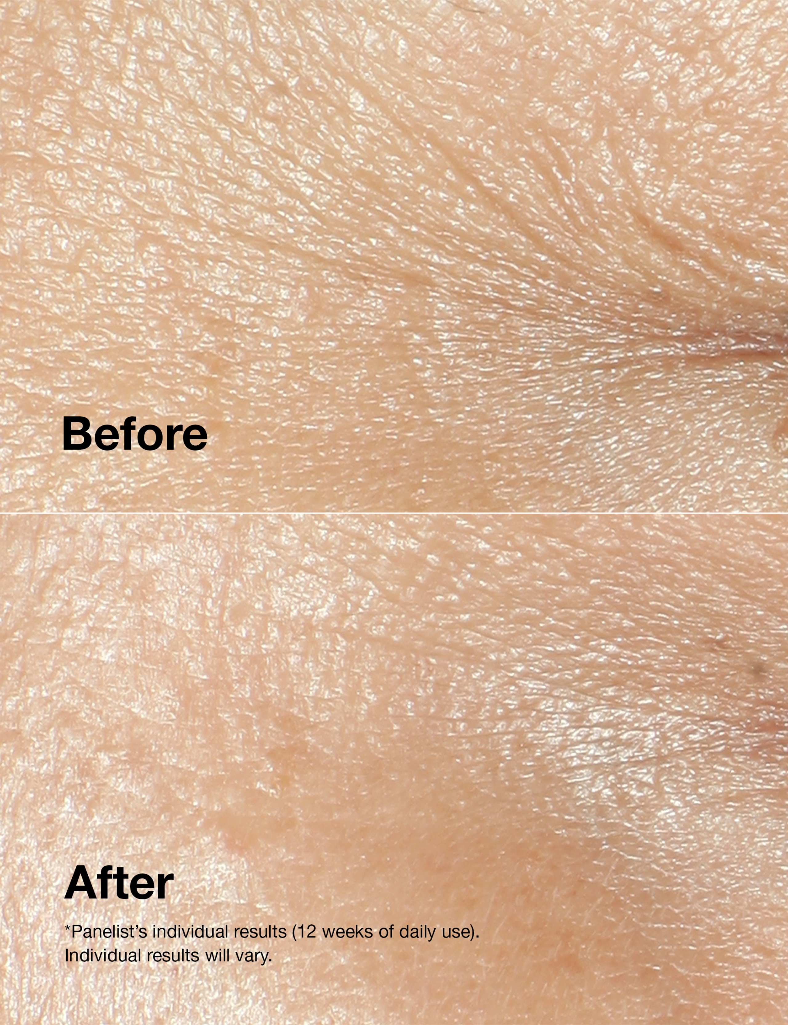 Clinique Smart Clinical Repair™ Wrinkle Correcting Cream 50ml 3 of 6