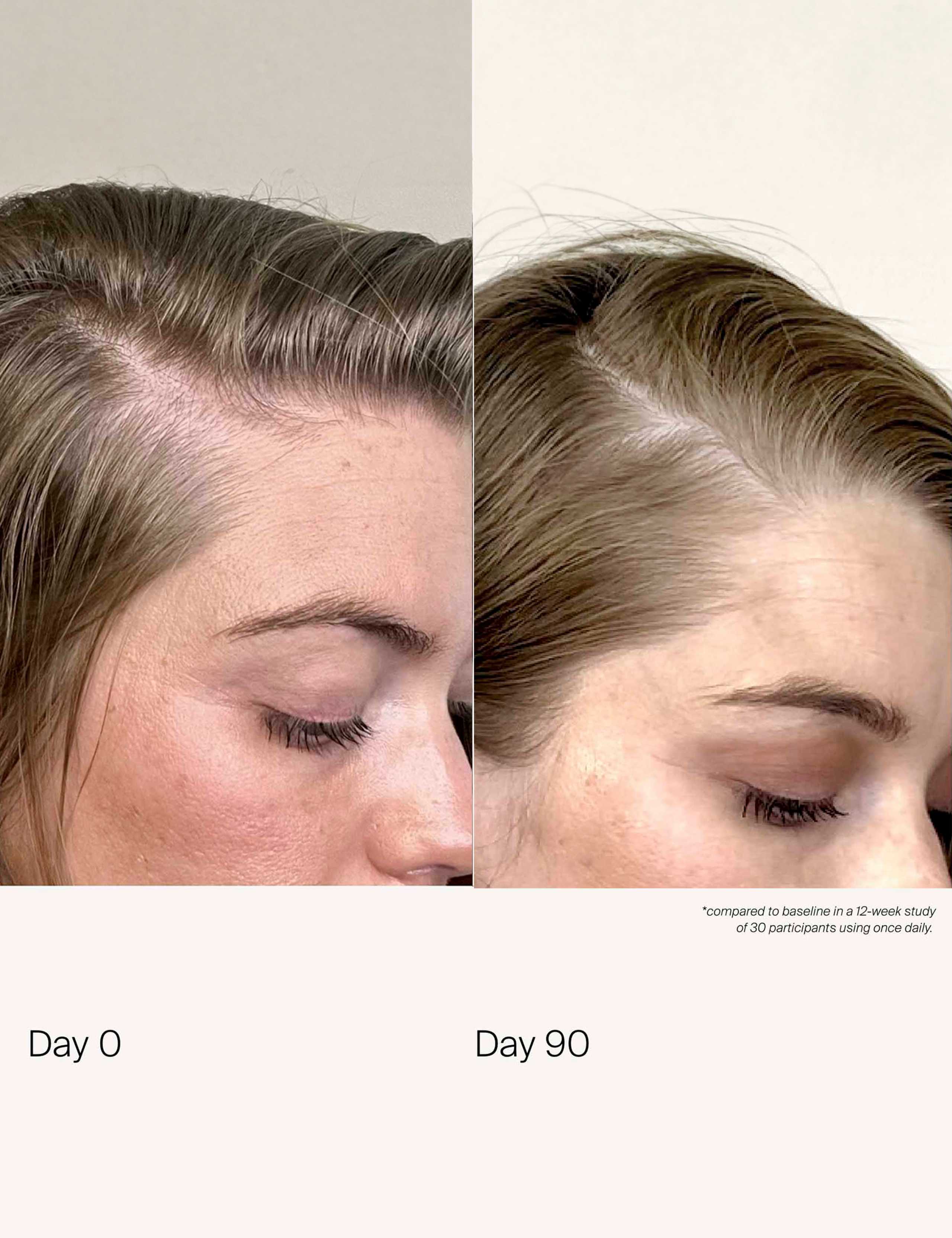 Scalp Care Density Serum 50ml 6 of 10