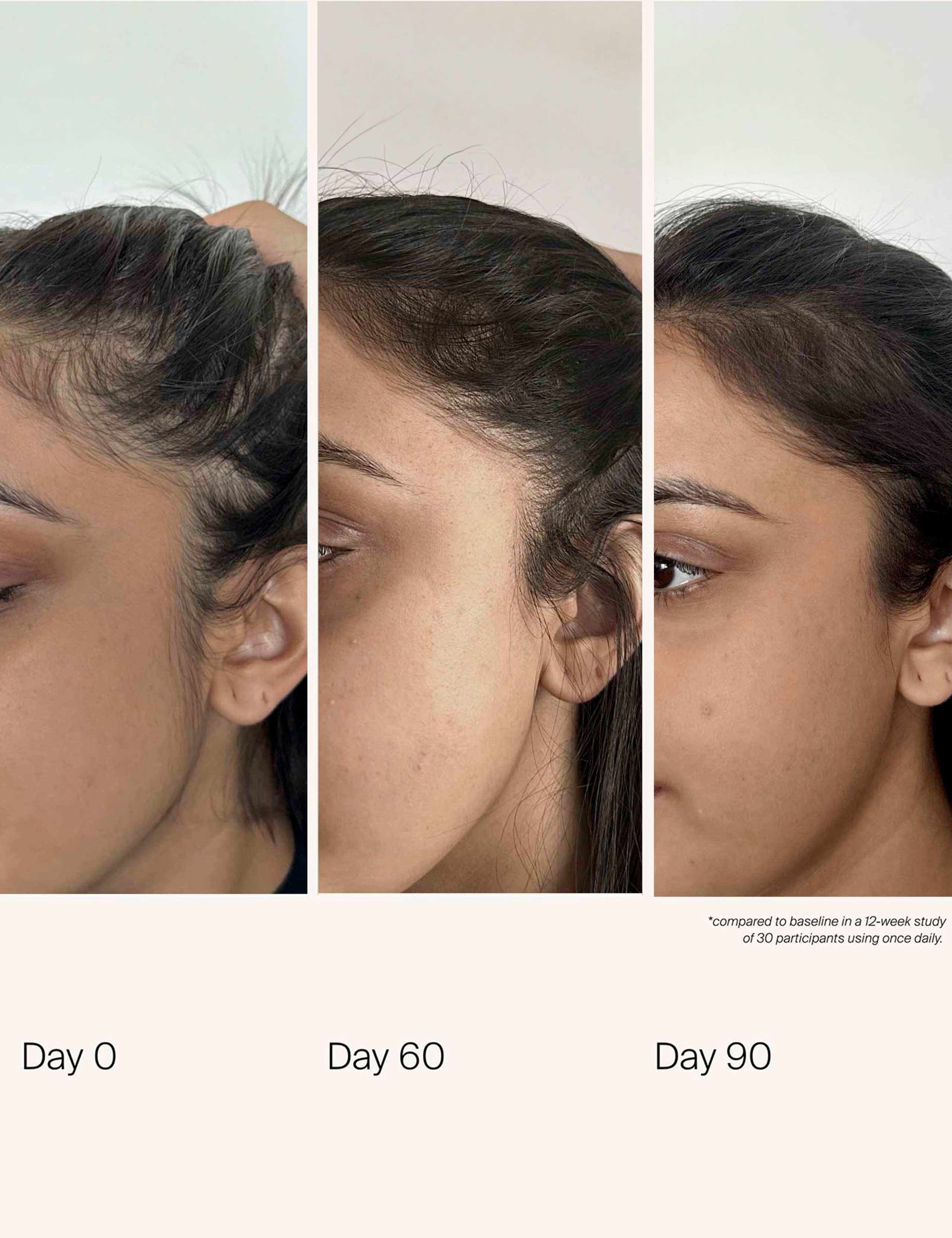 Scalp Care Density Serum 50ml 7 of 10