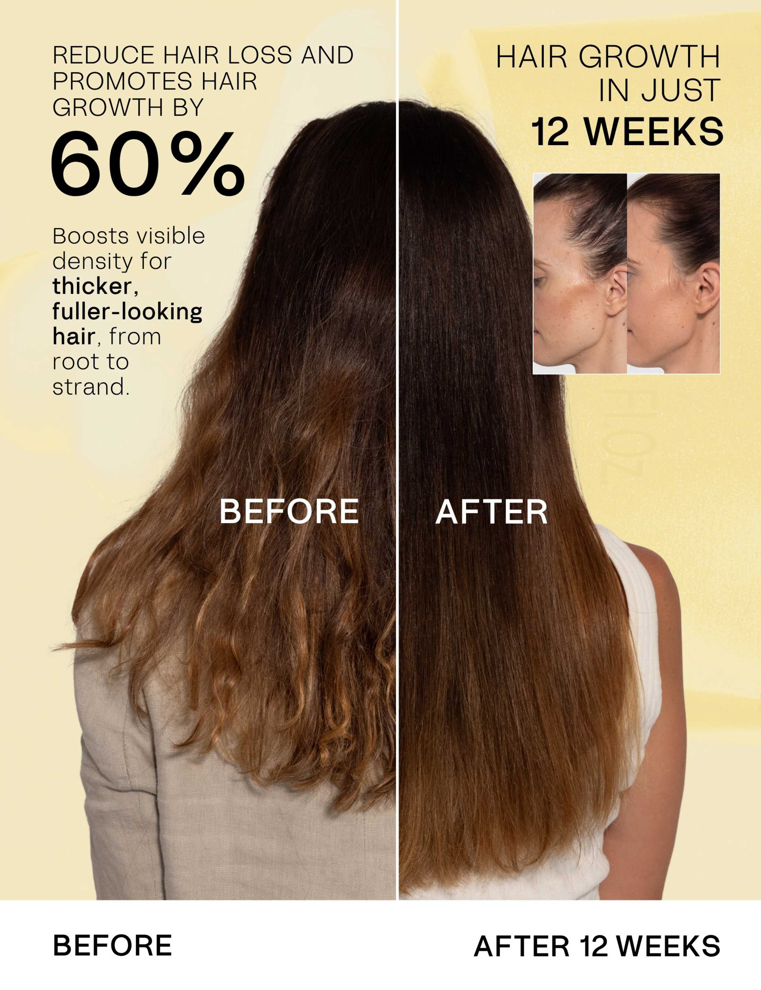 Daily Hair Growth & Refresh Kit 7 of 7
