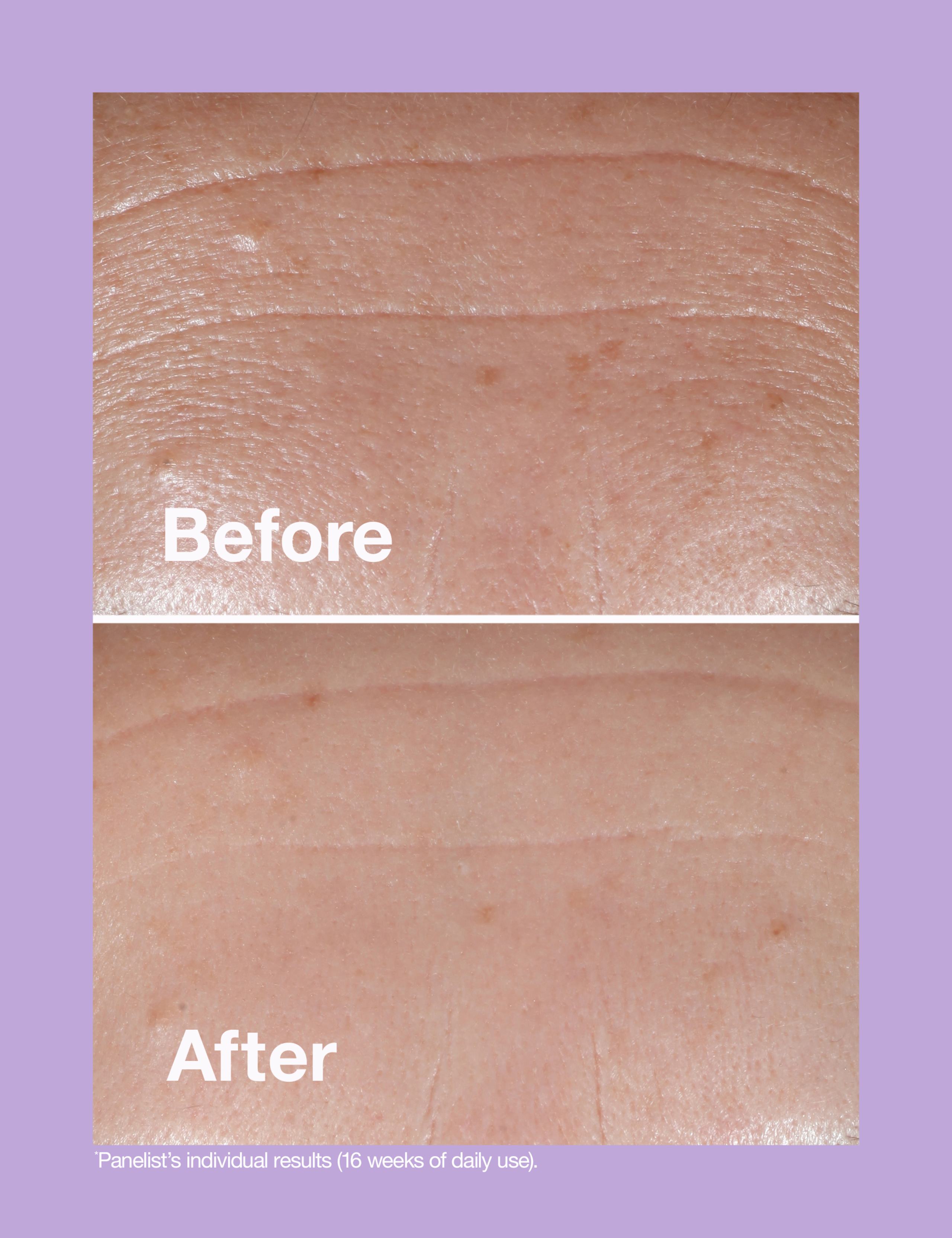 Smart Clinical Repair™ Wrinkle Correcting Serum 30ml 3 of 6