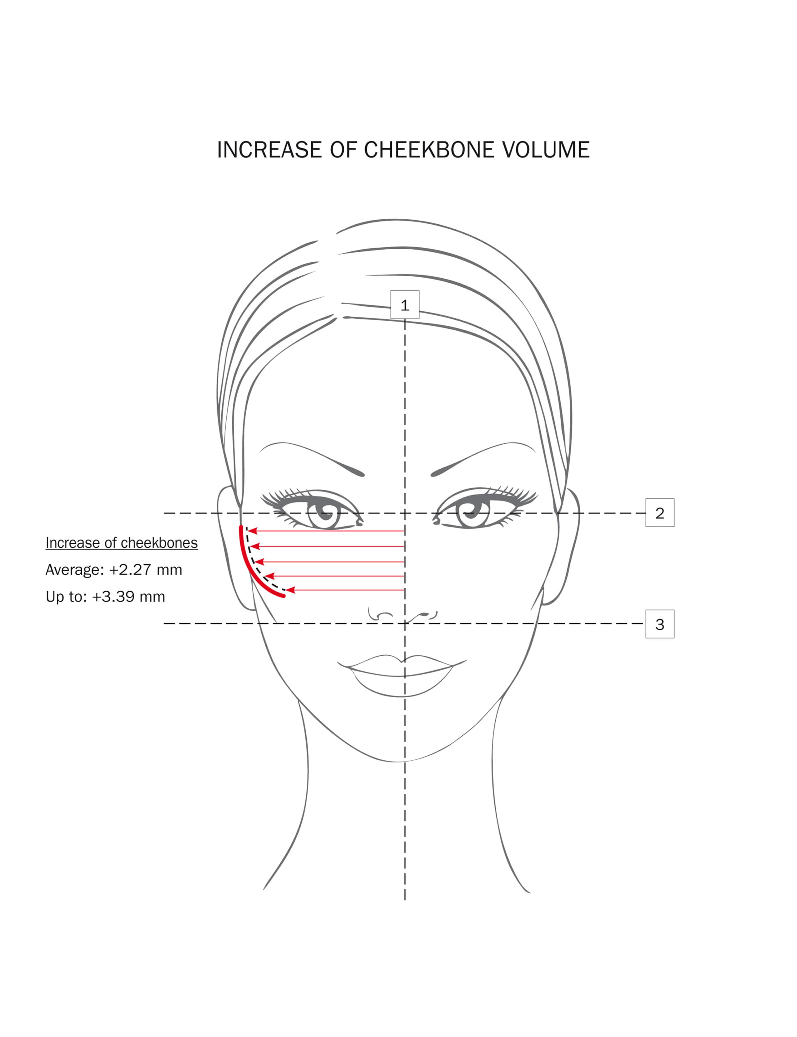 Grade 2 Filler Gel Treatment Kit 7 of 7